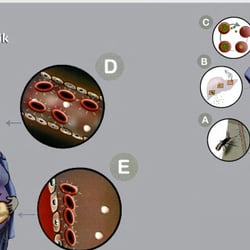 Infografik