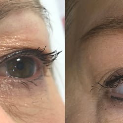 Microblading