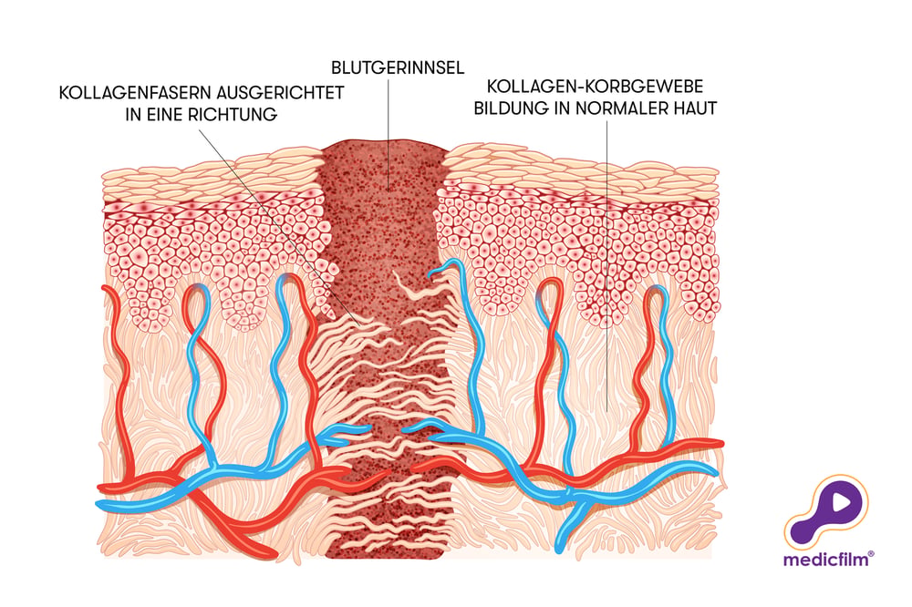 Kollagenbildung – Epidermis