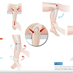 Illustrationen für „Orthopädie & Unfallchirurgie“ /  2011