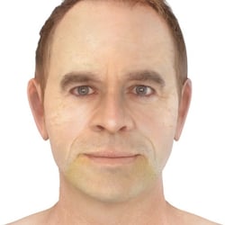 PFV Antlitzdiagnostik Male No6