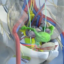 3D Medizinische Animation 3