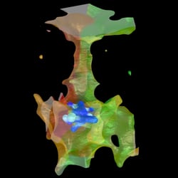 Innere Pore eines bakteriellen spannungsabhängigen Calcium-Kanals mit gebundenem Inihibitor (Br-Verapamil)