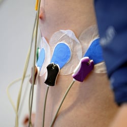 ekg