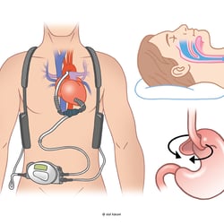 Illustrationen für HÖRZU Gesundheit • Funke Mediengruppe