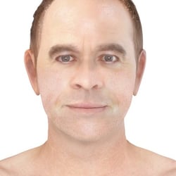 PFV Antlitzdiagnostik Male No8
