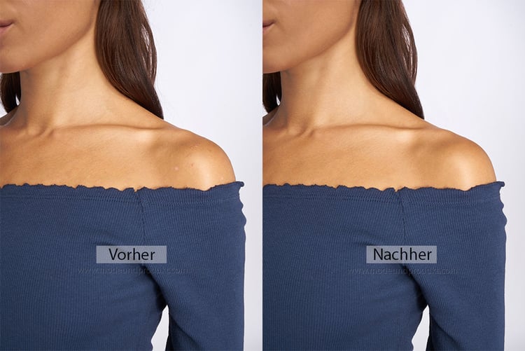 skin retouch