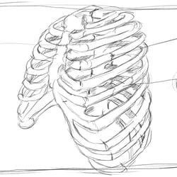 MedXpert STRACOS 3D‑Rippenklammer 3D-Animation Storyboard