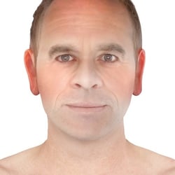 PFV Antlitzdiagnostik Male No3