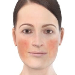PFV Antlitzdiagnostik FeMale No7