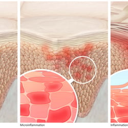 Epidermis detail
