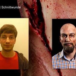 Alter Mann mit Schnittwunde