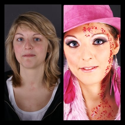 vorher/nachher