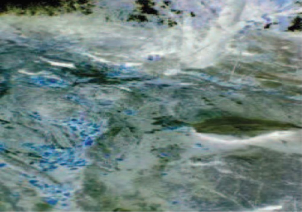 Kj 9−1