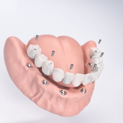 Thommen Medical – Implantologie Visuals