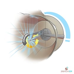 SKM Spritzsystem für D.W. Renzmann Apparatebau