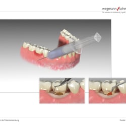 3D-Animation; Dampsoft, Damp