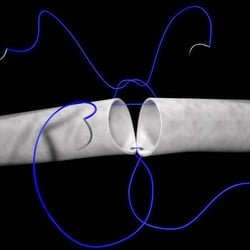 Grafik Nahtkurs1, für Klinikum Heidelberg