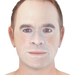 PFV Antlitzdiagnostik Male No4