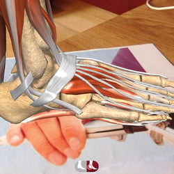 Augmented Reality App zu Erkrankungen des Fusses