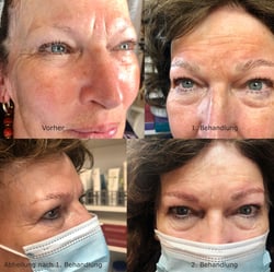Microblading