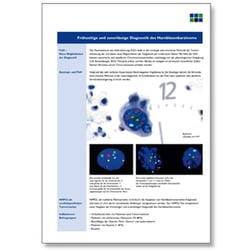 Krebsdiagnostik, Flyer / cancer diagnostics, flyer / wagnerstibbe