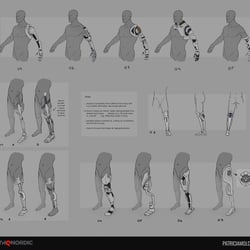 prosthetic options