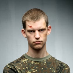 Lukaswunde1