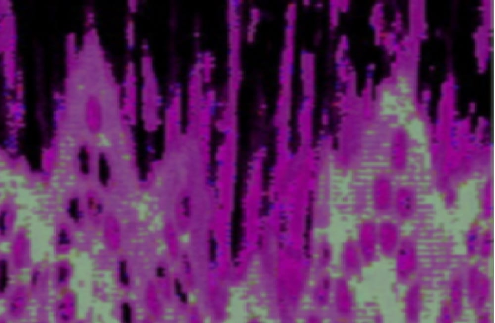 PT 10−2a