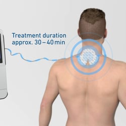 3D-Anwenderanimation STIM PRO X9+: Behandlung