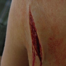 schulterwunde skinart