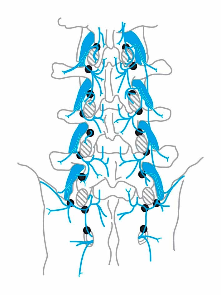 Minimalinvasive Wirbelsäulen Intervention 02