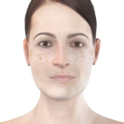 PFV Antlitzdiagnostik FeMale No12