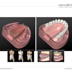 3D-Modelle für Patientenberatungssoftware, Quintessenz-Verlag, Berlin