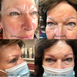 Microblading