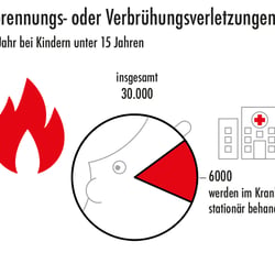 Feuer- und Verbrennungsschutz – so schützen Sie Ihr Kind