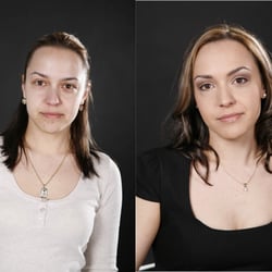Vorher/Nachher