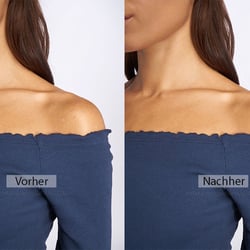 skin retouch