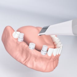 Thommen Medical – Implantologie Visuals