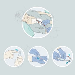 Dialyse – Illustrationen für eine Anwendungsbeschreibung