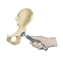 Vorbereiten der Hüftpfanne (Acetabulum) für die Implantation einer künstlichen Hüfte