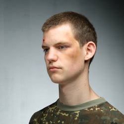 lukaswunde3