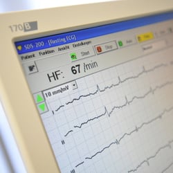 ekg