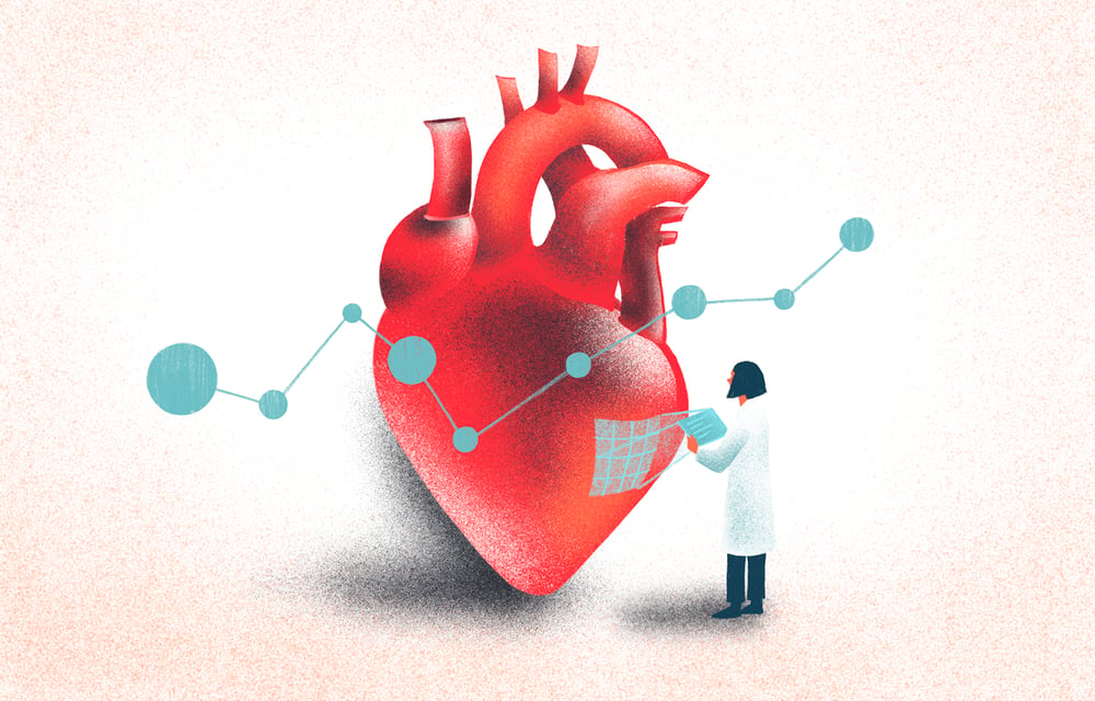 Illustration—heart medtech