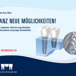 Broschüre – Implantatsystem Endopore