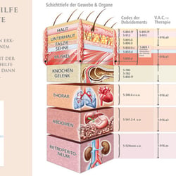 Kodierhilfe / Grafik für KCI