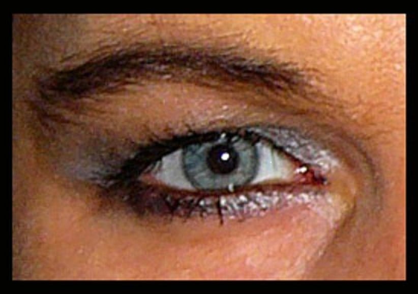 Auge.1jpg