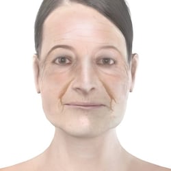 PFV Antlitzdiagnostik FeMale No11