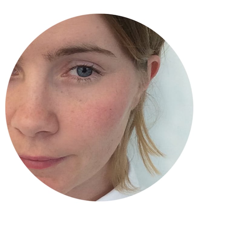 Anna-Lina Ulm