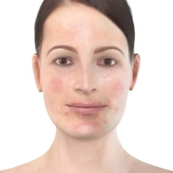 PFV Antlitzdiagnostik FeMale No9